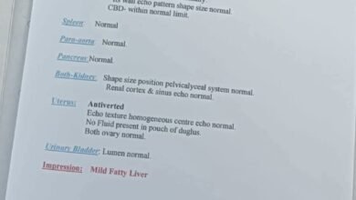 Photo of सतना में दो अस्पतालों की गंभीर लापरवाही उजागर, सोनोग्राफी में पुरुष का गर्भाशय दिखाया, पैथोलॉजी रिपोर्ट पर फर्जी हस्ताक्षर का आरोप